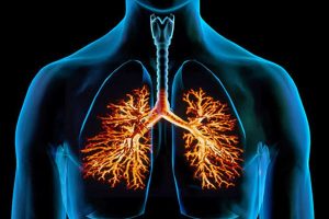 BRONCHITIS contraindications In beauty therapy