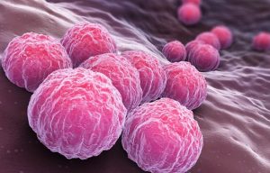 CHLAMYDIA contraindications In beauty therapy