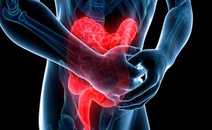 COLITIS contraindications In beauty therapy