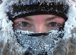 FROSTBITE contraindications In beauty therapy