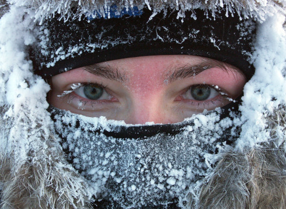FROSTBITE contraindications In beauty therapy
