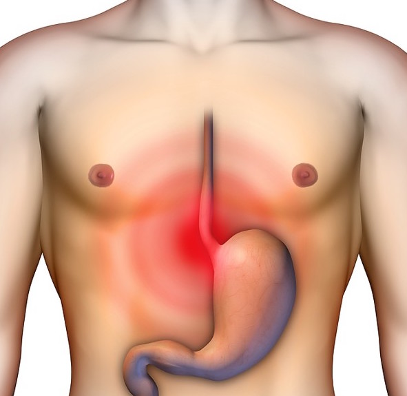 HIATUS HERNIA contraindications In beauty therapy