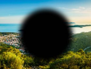 MACULAR DEGENERATION contraindications In beauty therapy