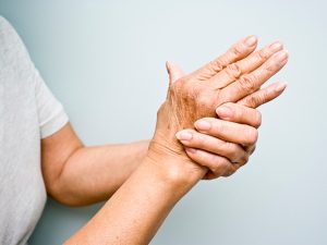RHEUMATOID ARTHRITIS contraindications In beauty therapy