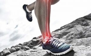 SHIN SPLINTS contraindications In beauty therapy